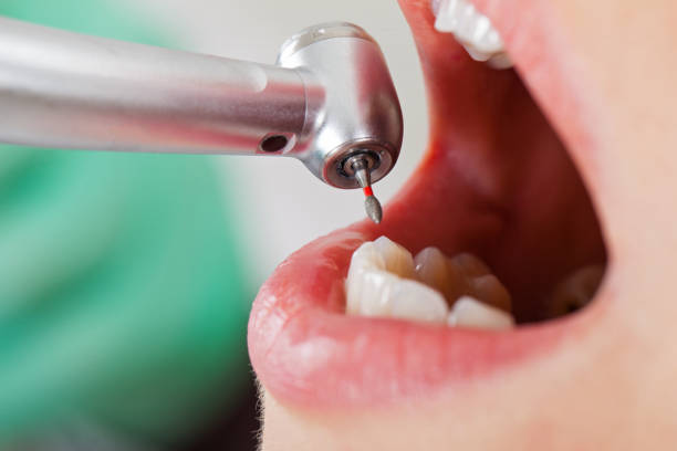 Best Emergency Root Canal Treatment in Geva, NE